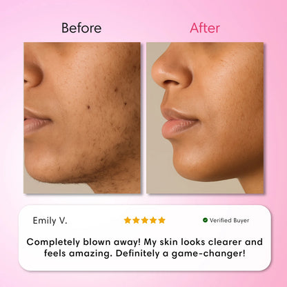 Hair Removal Trilogy Kit