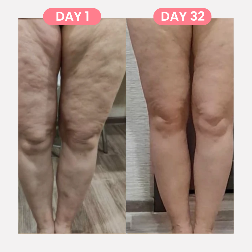 CelluSculpt™